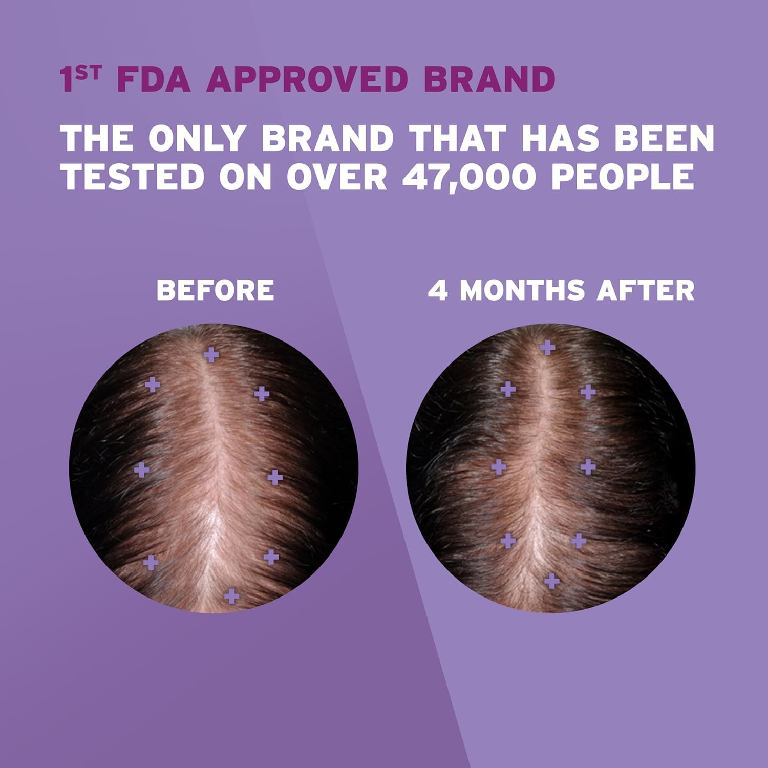 Premium Women's Rogaine Minoxidil 2% Liquid – Targeted Hair Regrowth | 3 Months